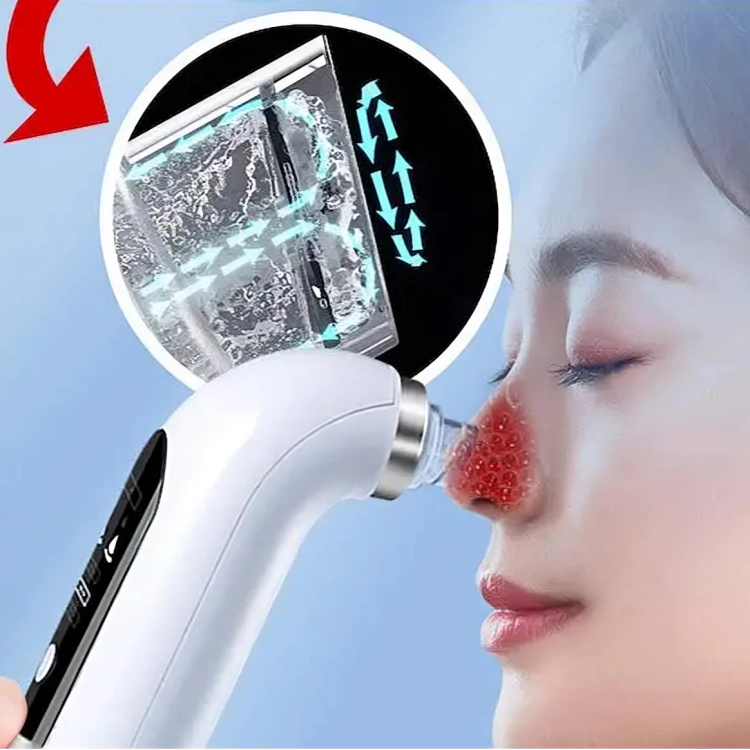 Bubble Blackhead Remover
