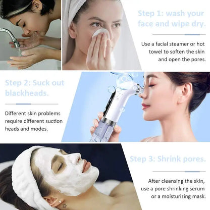 Bubble Blackhead Remover