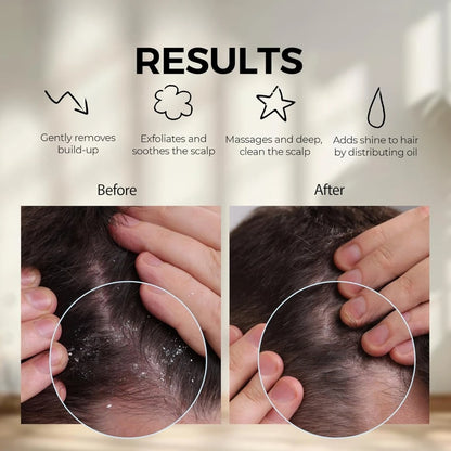 Scalp massage scrubber